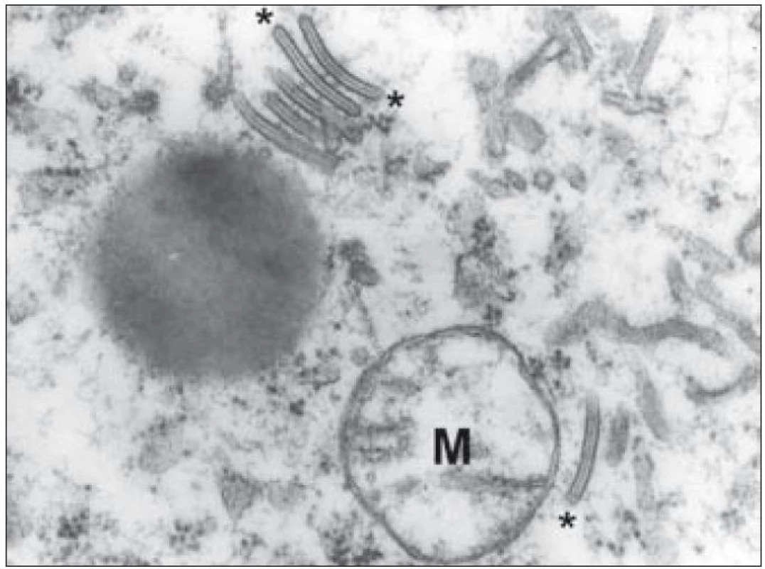 Ultrastrukturální snímek výseku cytoplazmy Langerhansovy buňky s typickými Birbeckovými granuly (označeny hvězdičkami). Pro srovnání velikosti – mitochondrie označena „M“.