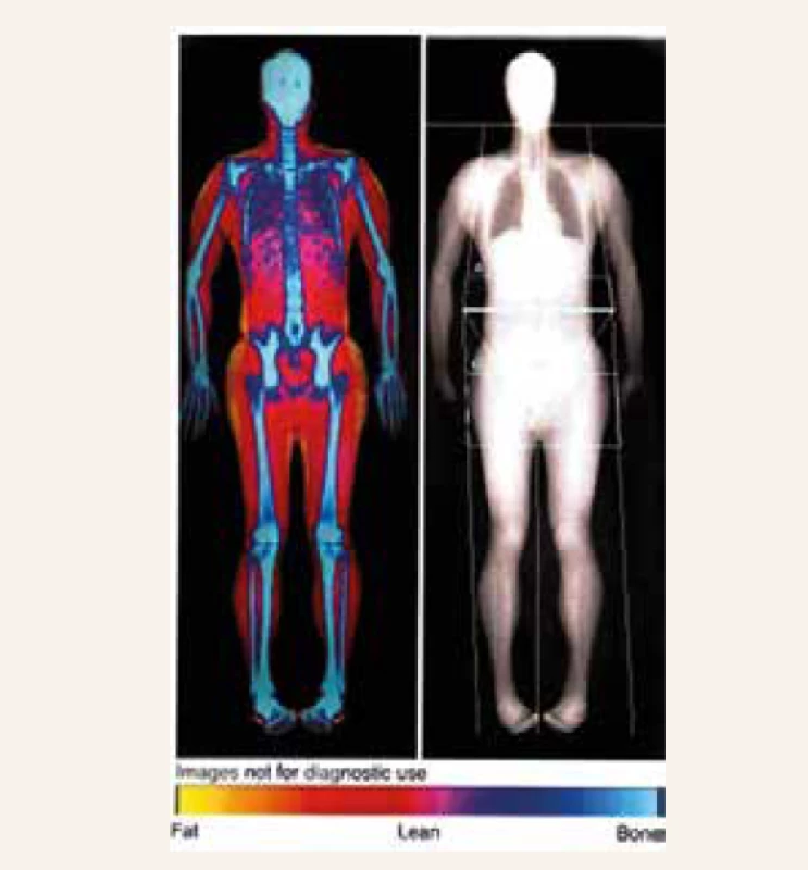 DXA scan of a whole body composition
measurement. <br>
Modified according to [13]