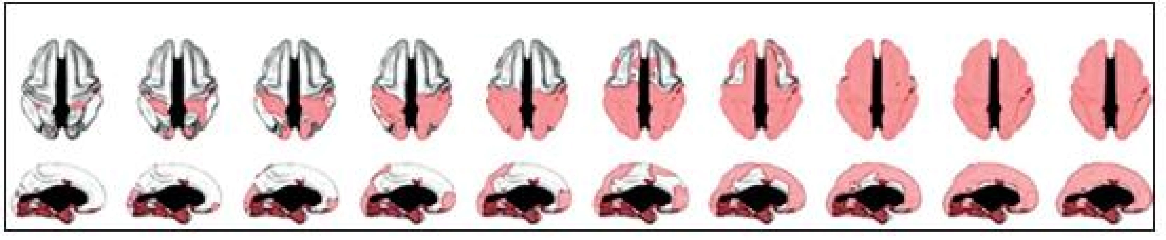Zleva doprava: růst regionální tloušťky mozkové kůry v dvouletých odstupech počínaje věkem 7 let, první nabývají senzorické a motorické korové oblasti, následují temenní a spánkové laloky, poslední jsou prefrontální korové oblasti (42).