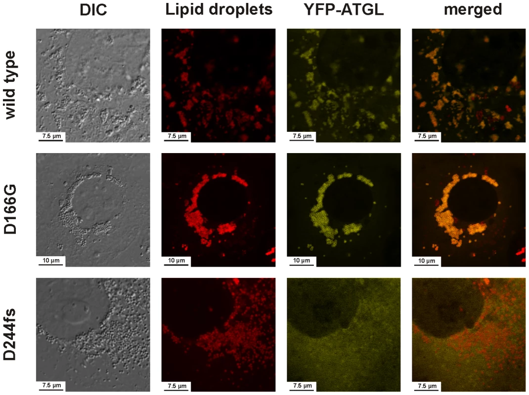 Intracellular localization of the wild-type ATGL protein and the mutants D166G and D244fs as determined by laser scanning microscopy.