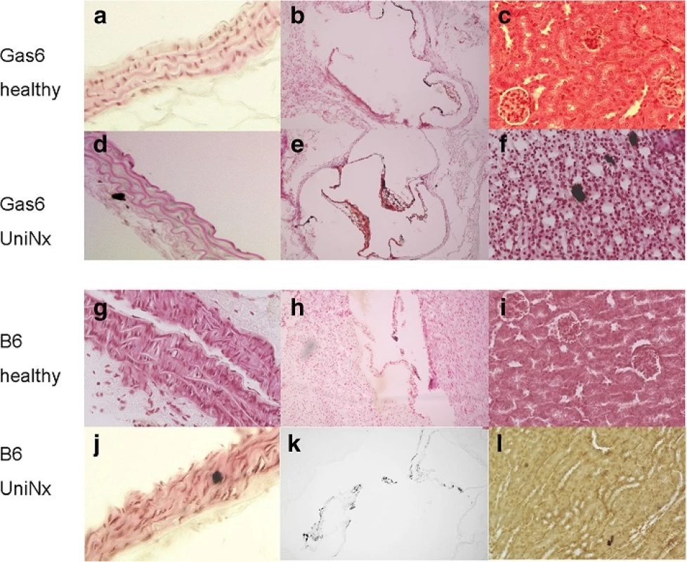 Localisation of calcium deposits; &lt;i&gt;Von Kossa&lt;/i&gt; staining of the aorta (a, d, g, j), heart (b, e, h, k) and kidney (c, f, i, l) after uninephrectomy in WT (Wildtype) compared to Gas6&lt;sup&gt;-/-&lt;/sup&gt; mice. WT; Magnification 400x