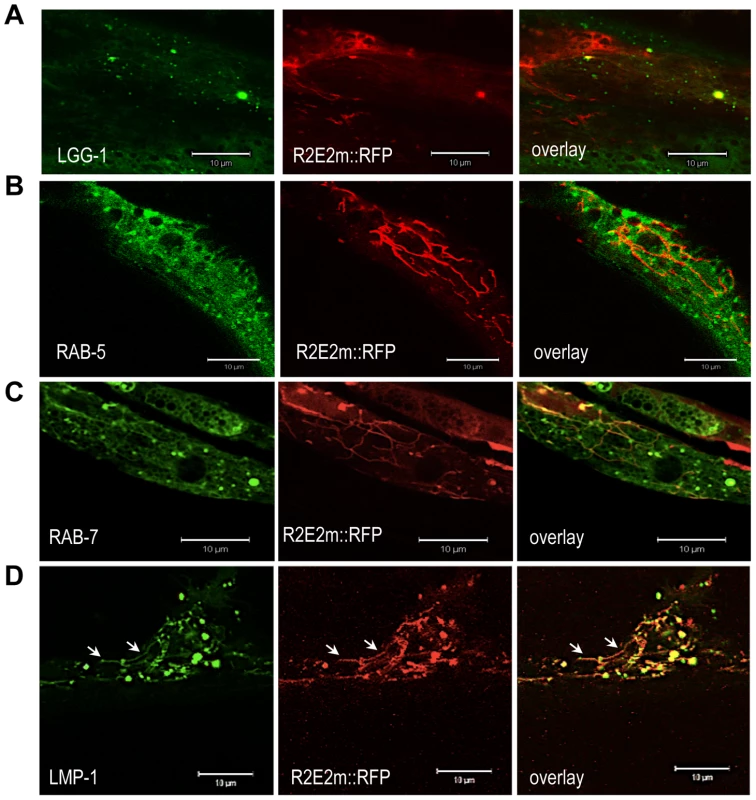 R2E2 co-localizes with autophagosomes, amphisomes, and autolysosomes.