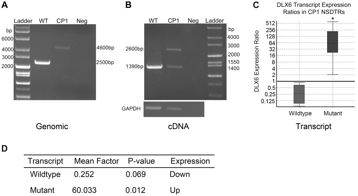 PCR amplification and expression analysis of LINE insertion in CP1 and WT NSDTRs.
