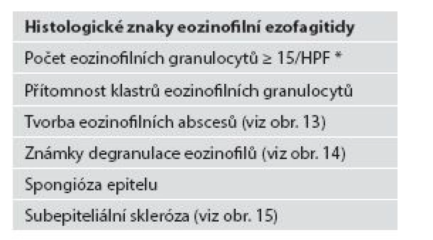 Histologické znaky eozinofilní ezofagitidy.