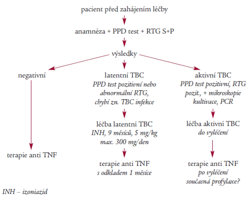 Doporučení pro prevenci TBC u pacientů léčených TNF blokujícími léky.