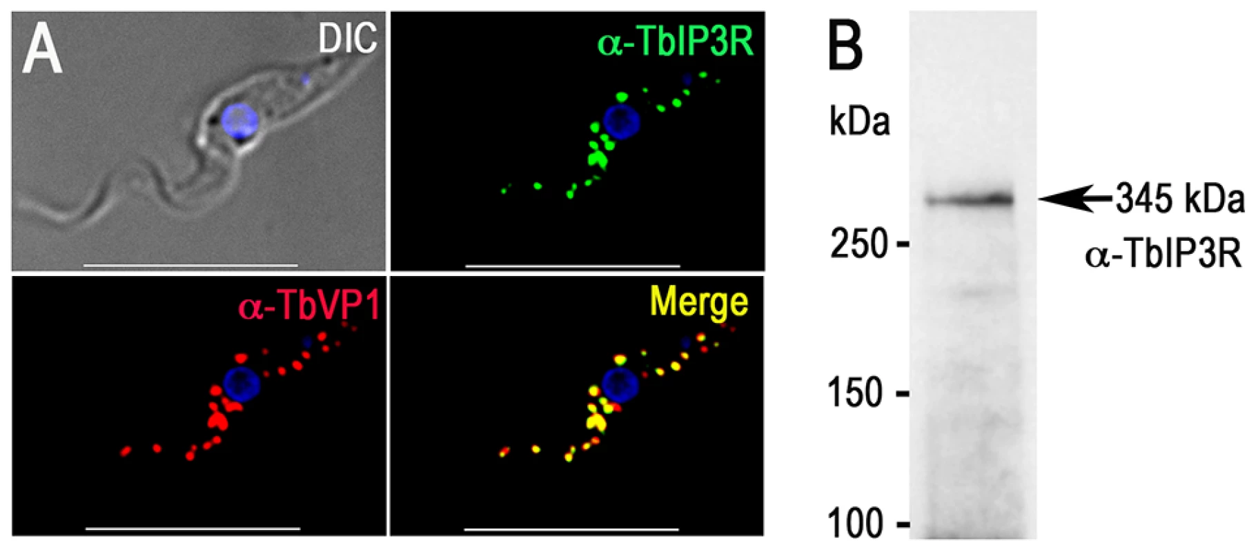 Immunofluorescence microscopy analysis of TbIP<sub>3</sub>R.