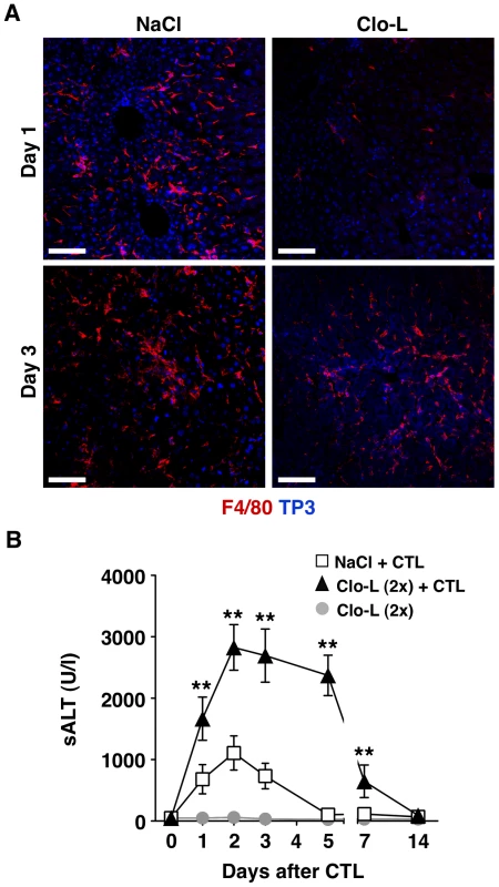 Recruitment of F4/80<sup>+</sup> cells into the inflamed liver and prolongation of disease severity in CTL-injected mice receiving a second Clo-L injection.