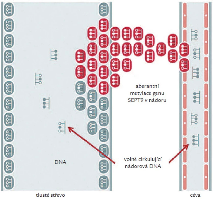 Epigenetické změny SEPT9 v krvi.