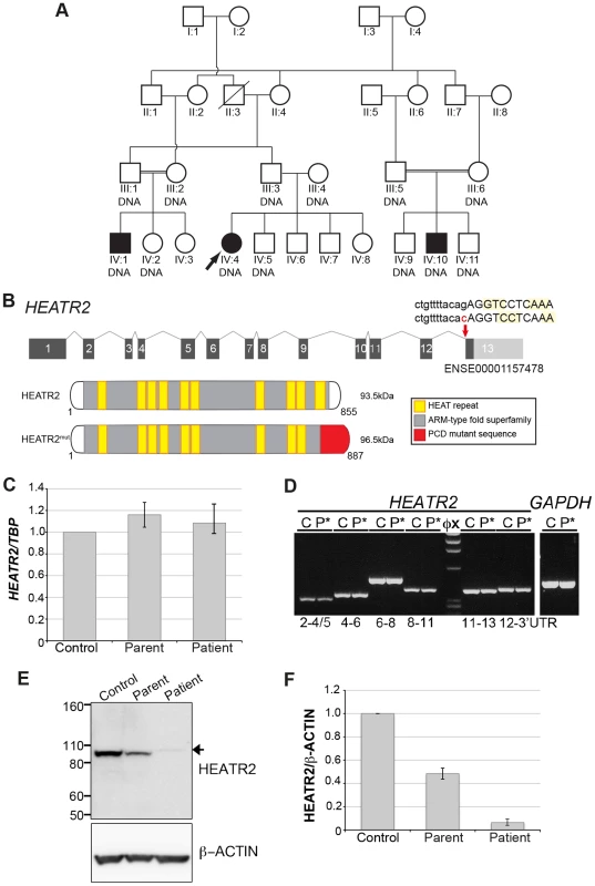 <i>HEATR2</i> splice mutation results in alteration of the final conserved HEAT repeat and protein instability.
