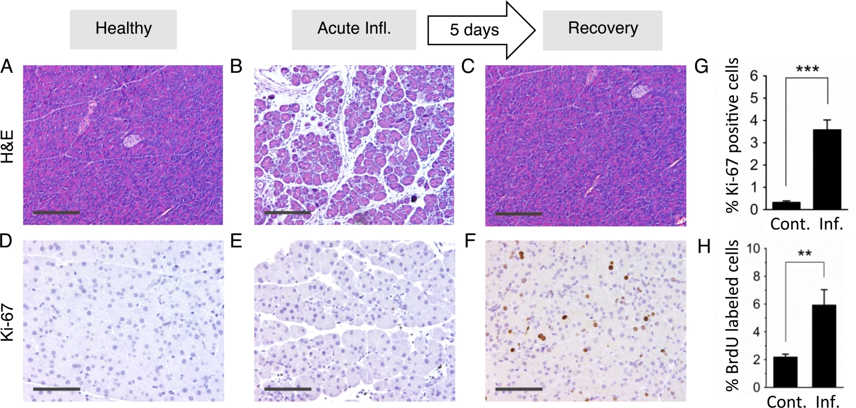 Inflammation and regenerative cell proliferation are separated in acute cerulein pancreatitis.