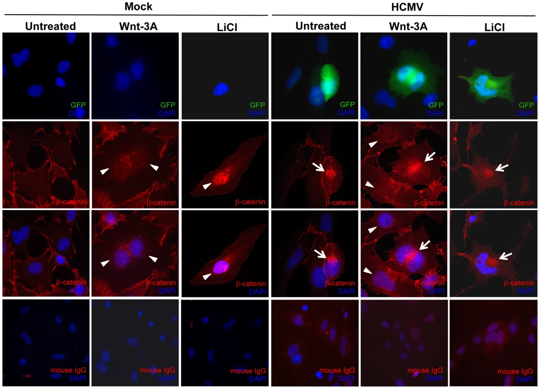 HCMV infection inhibits β-catenin nuclear translocation in EVTs.