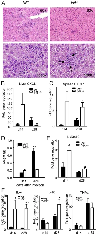 <i>Irf5</i><sup>-/-</sup> mice do not develop Th1-type granulomas.