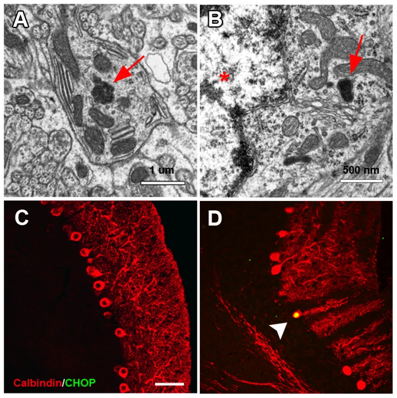 Abnormal protein aggregation and upregulated ER stress marker in the cerebellum of <i>nur17</i> mice.