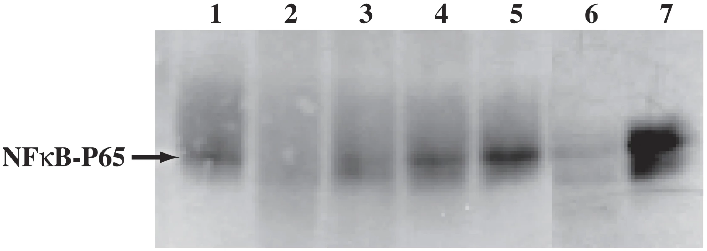 Proteolytic cleavage of r-human NF-κB P65 by wild type- and r-cruzain but not by proteases expressed by cruzain-deficient <i>T. cruzi.</i>