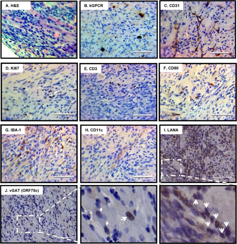 Pathological analysis of angiogenic tumors derived from γHV68.kGPCR-infected mice.