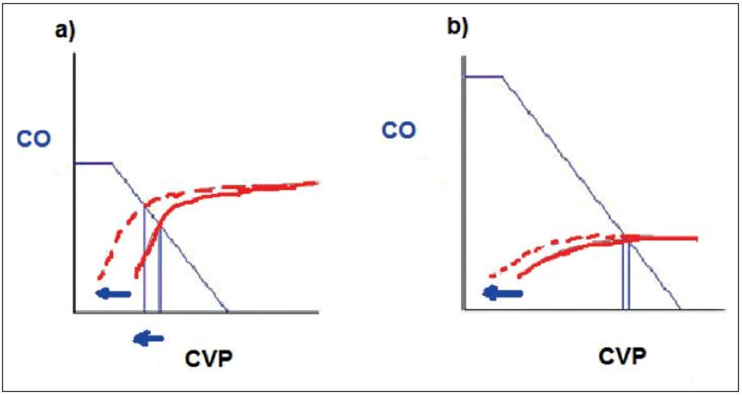 Srdeční funkční křivka Vztah mezi srdečním výdejem – CO a centrálním žilním tlakem – CVP