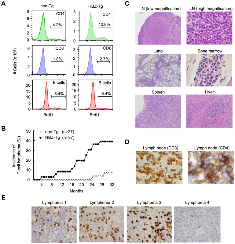 <i>HBZ-</i>Tg mice develop T-cell lymphoma after a long latent period.