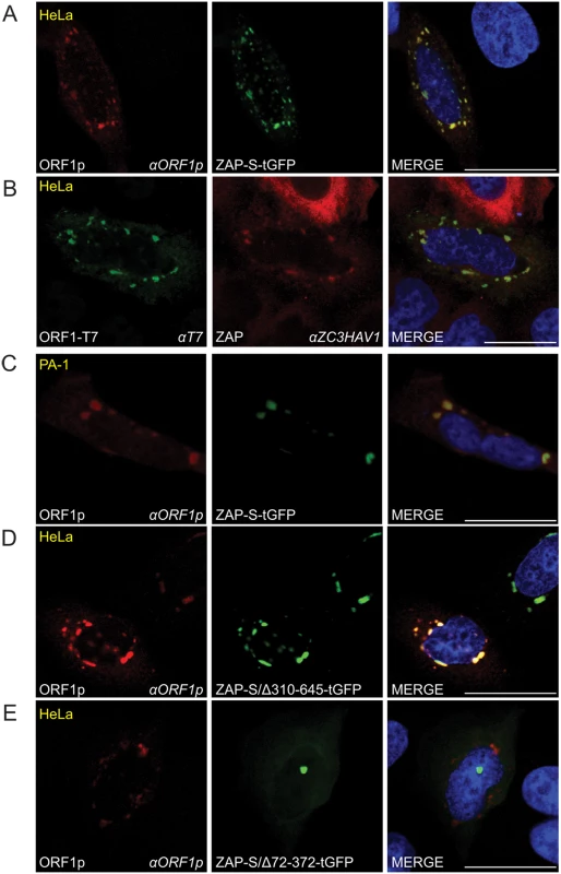 The co-localization of ORF1p and ZAP in cytoplasmic foci.