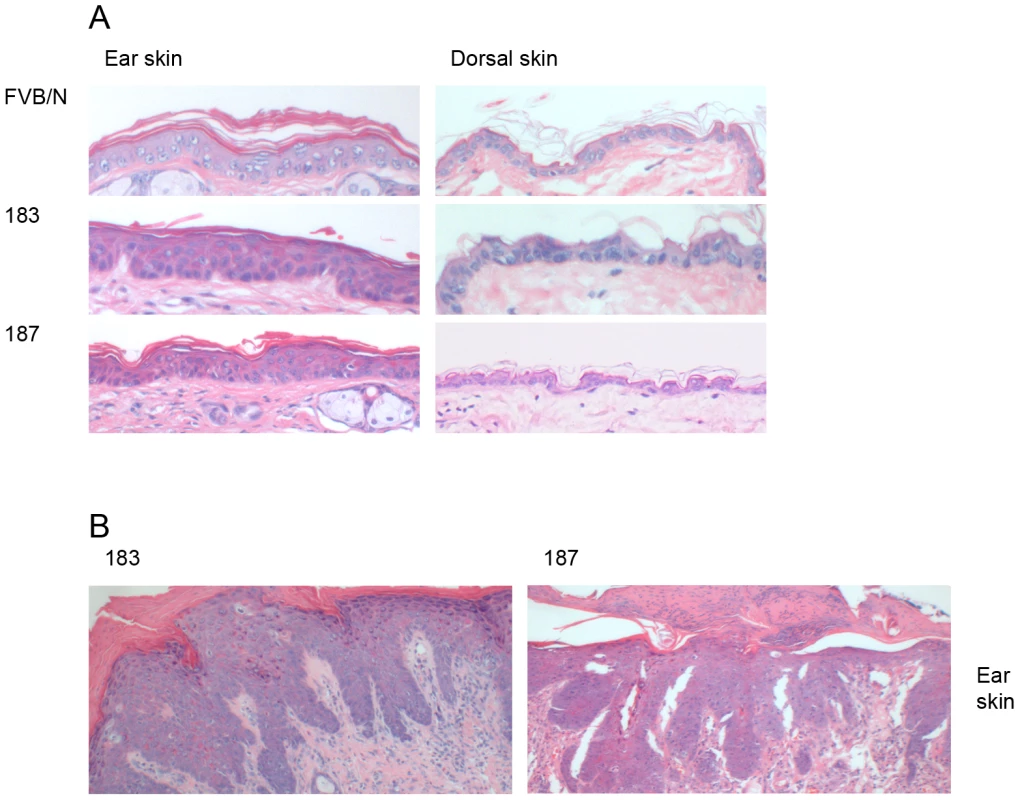 Histological analysis of skin specimens from wild-type FVB/N and Tg mouse lines.
