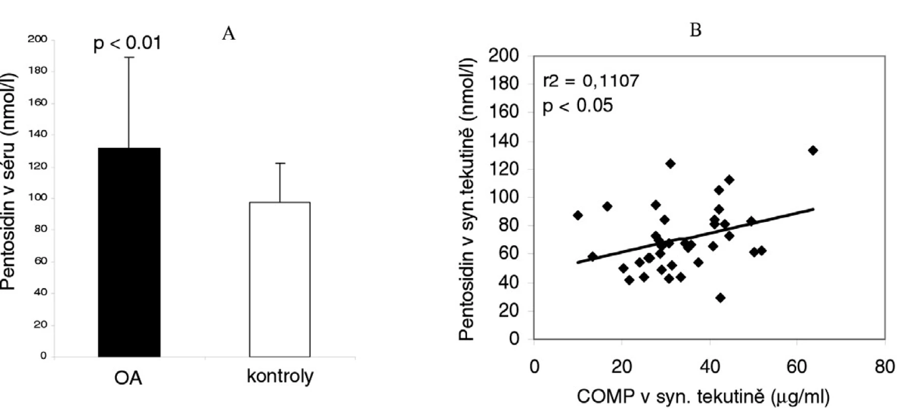 Porovnání sérové hladiny pentosidinu u pacientů s osteoartrózou (OA) kolenních kloubů s kontrolní skupinou (A) a korelace pentosidinu s ukazatelem destrukce chrupavky COMP v synoviální tekutině pacientů s OA kolenních kloubů (B).