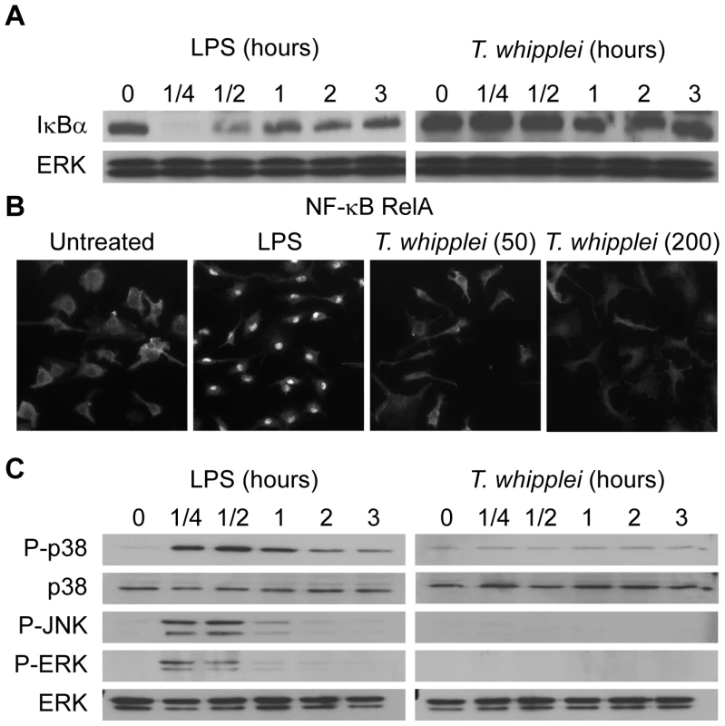 <i>T. whipplei</i> poorly induces NF-κB and MAPK pathways.