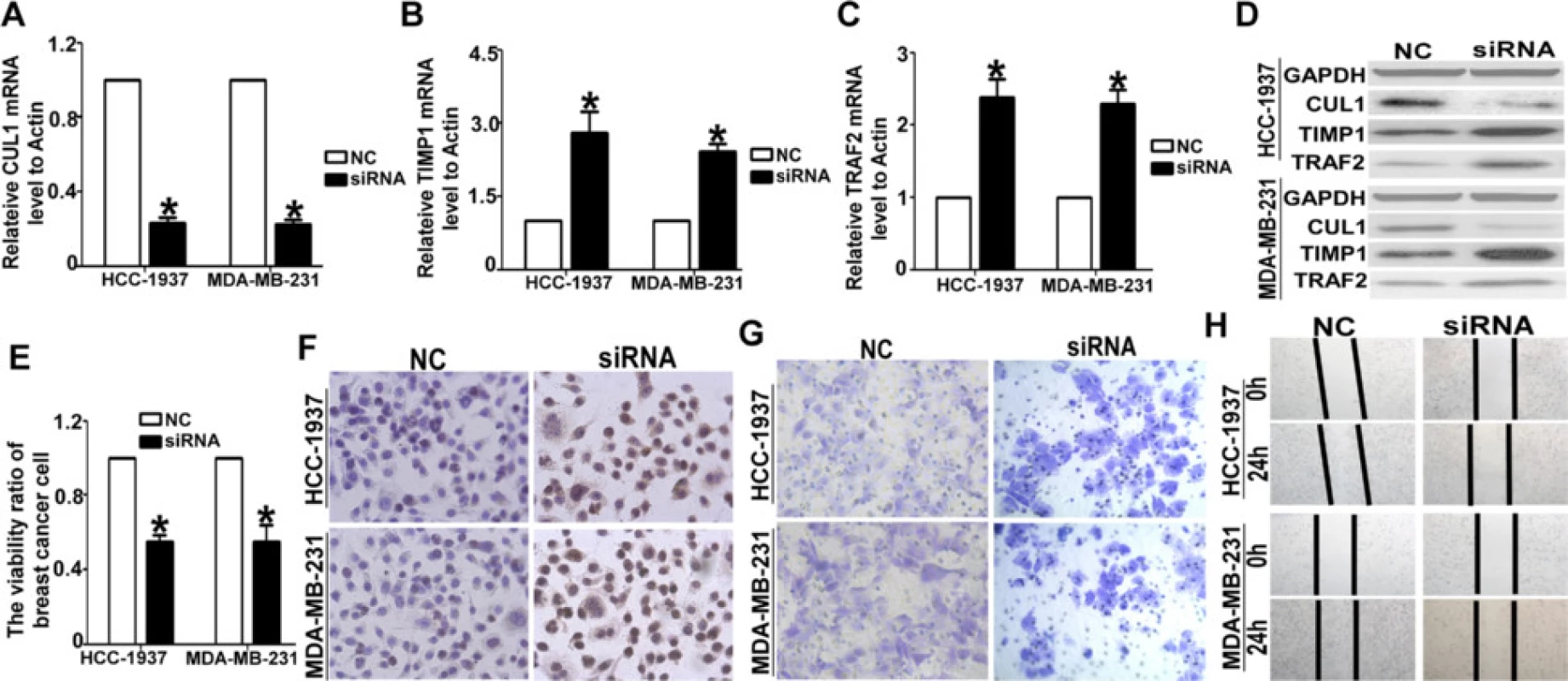 Knocked-down the CUL1 lead to the same effect of Selumetinib. a The siRNA could effective inhibited the CUL1 expression on mRNA levels (For HCC1973 cells, the CUL1 level was 0.23HCC19. For MDA-MB-231 cells, the CUL1 level was 0.22 ± 0.04.*P &lt; 0.01 compared with the NC group, which is 1.). b After silencing the CUL1, the TIMP1 level was increased (For HCC1973 cells, the TIMP1 level was 2.81 ± 0.75. For MDA-MB-231 cells, the TIMP1 level was 2.41 ± 0.23.*P &lt; 0.01 compared with the NC group, which is 1.). c The tendency of TRAF2 mRNA expression levels in MDA-MB-231 and HCC-1937 cells were equal to TIMP1 determined by QRT-PCR (For HCC1973 cells, the TRAF2 level was 2.38 ± 0.45. For MDA-MB-231 cells, the TRAF2 level was 2.29 ± 0.33. *P &lt; 0.01 compared with the NC group, which is 1.). d the CUL1, TIMP1 and TRAF2 protein expression levels in HCC-1937 and MDA-MB-231 cells were examined by WB analysis. e After transfected the siRNA-CUL into HCC-1937 and MDA-MB-231 cells, the cell proliferation ratio was inhibited significantly (For HCC1973 cells, the viability ratio was 0.55 ± 0.06. For MDA-MB-231 cells, the viability ratio was 0.53 ± 0.15. *P &lt; 0.01 compared with the NC group, which is 1.). f the Tunnel analysis clarified this negative effect of siRNA-CUL1. g The transwell analysis showed, the numbers of the migrated cells in the NC group of both two TNBC cells, are almost double that are in the siRNA-CUL1 group h. The wound-healing assay showed the cell migration ability was reduced observably in siRNA-CUL1 group. For the NC group, the gap closure rate is more than two to thirds in both HCC-1937 and MDA-MB-231 cells. For siRNA-CUL1 group, the gap closure rate is less than one thirds