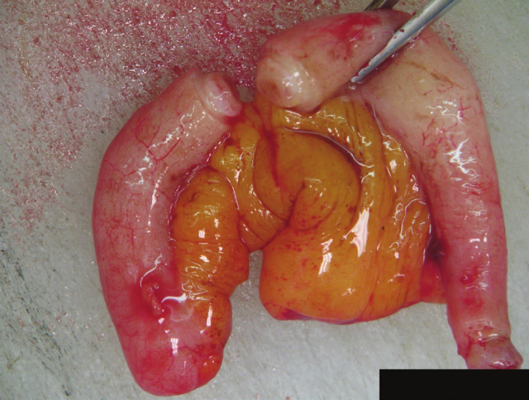 Preparát appendixu
Fig. 4: Appendix specimen