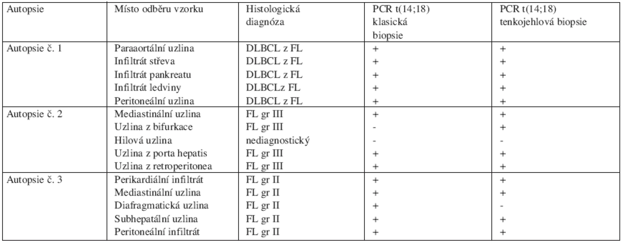 Srovnání kvalitativního záchytu t(14;18) polymerázovou řetězovou reakcí (PCR) v párových vzorcích odebraných punkční (FNA) a klasickou biopsií.
