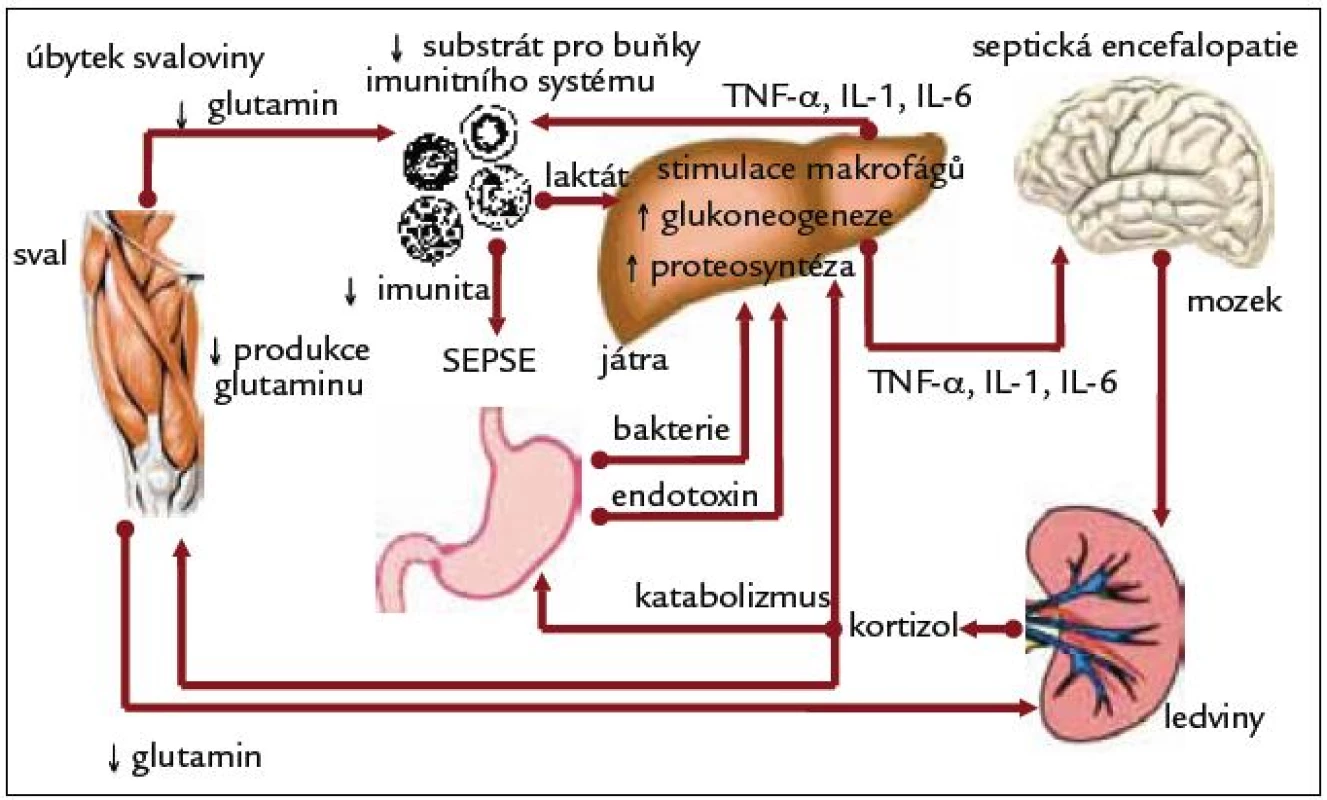 Vliv glutaminu na komplikace akutní pankreatitidy (translokace, sepse, MOF). Podle [8].