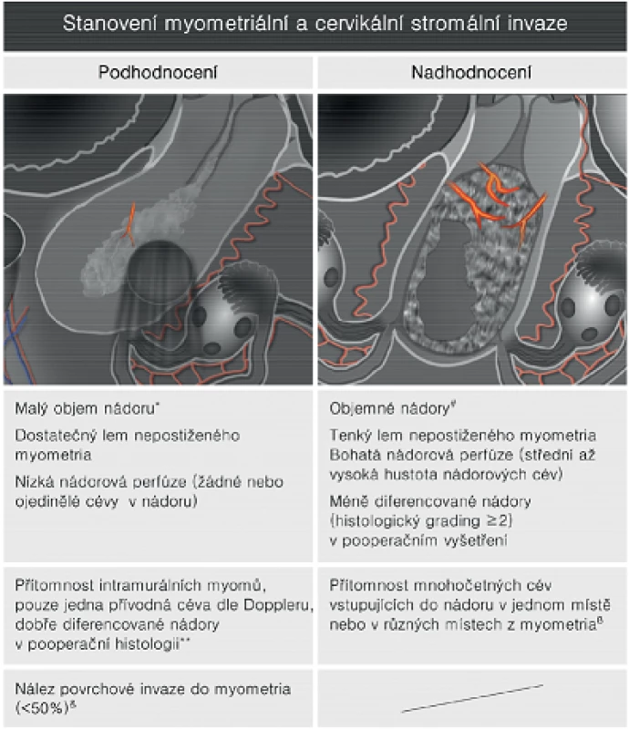Faktory ovlivňující ultrazvukovou přesnost předoperačního stagingu u zhoubného nádoru děložního těla
