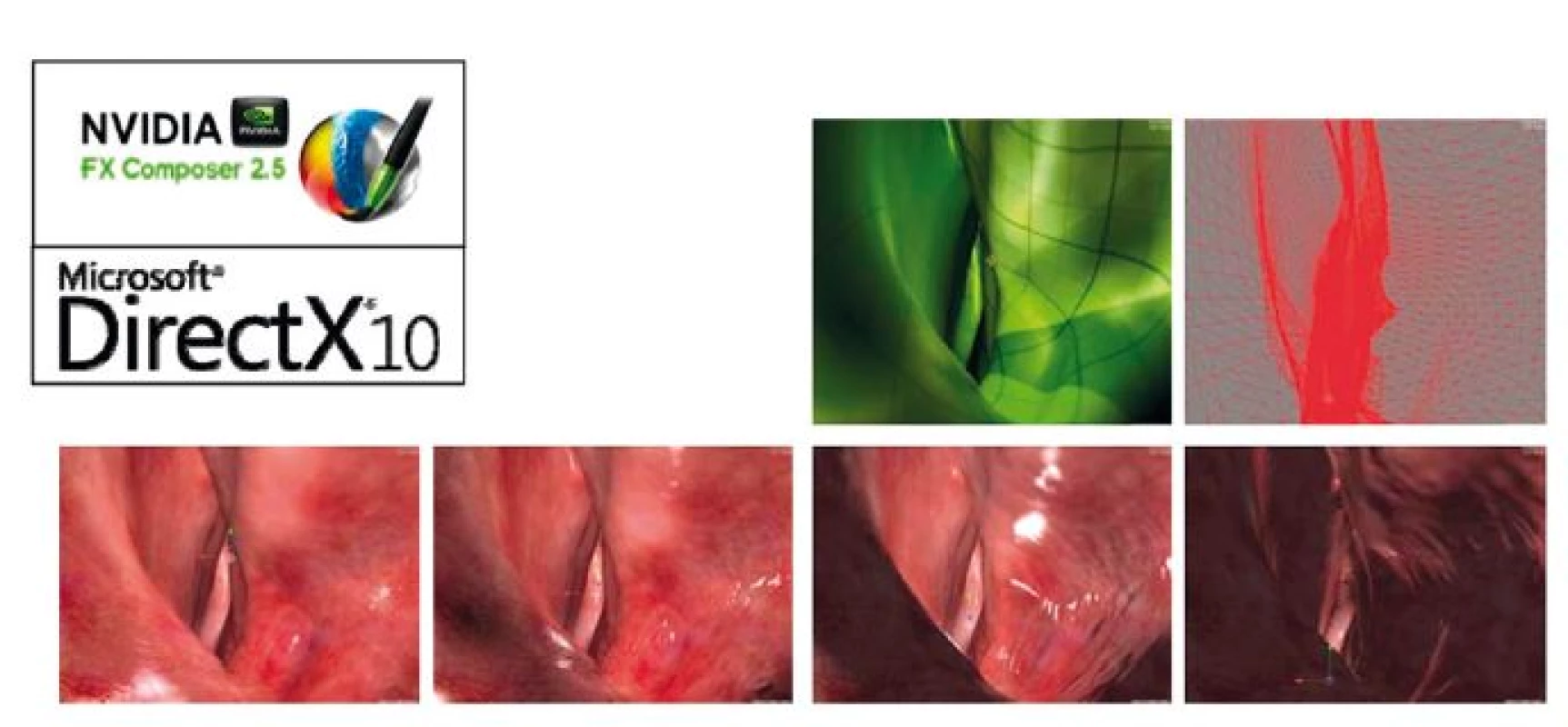 Grafické zobrazenie inštrumentov (GPRWMF Endoscopic Sinus Simulation).