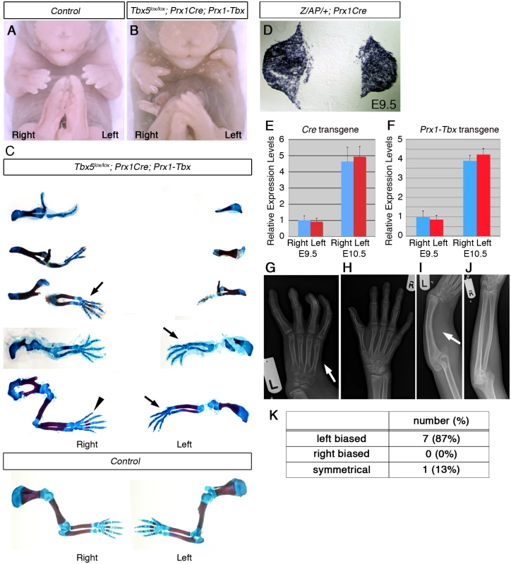 A mouse <i>Tbx</i> hypomorph mutant produces left-biased asymmetric forelimb defects.