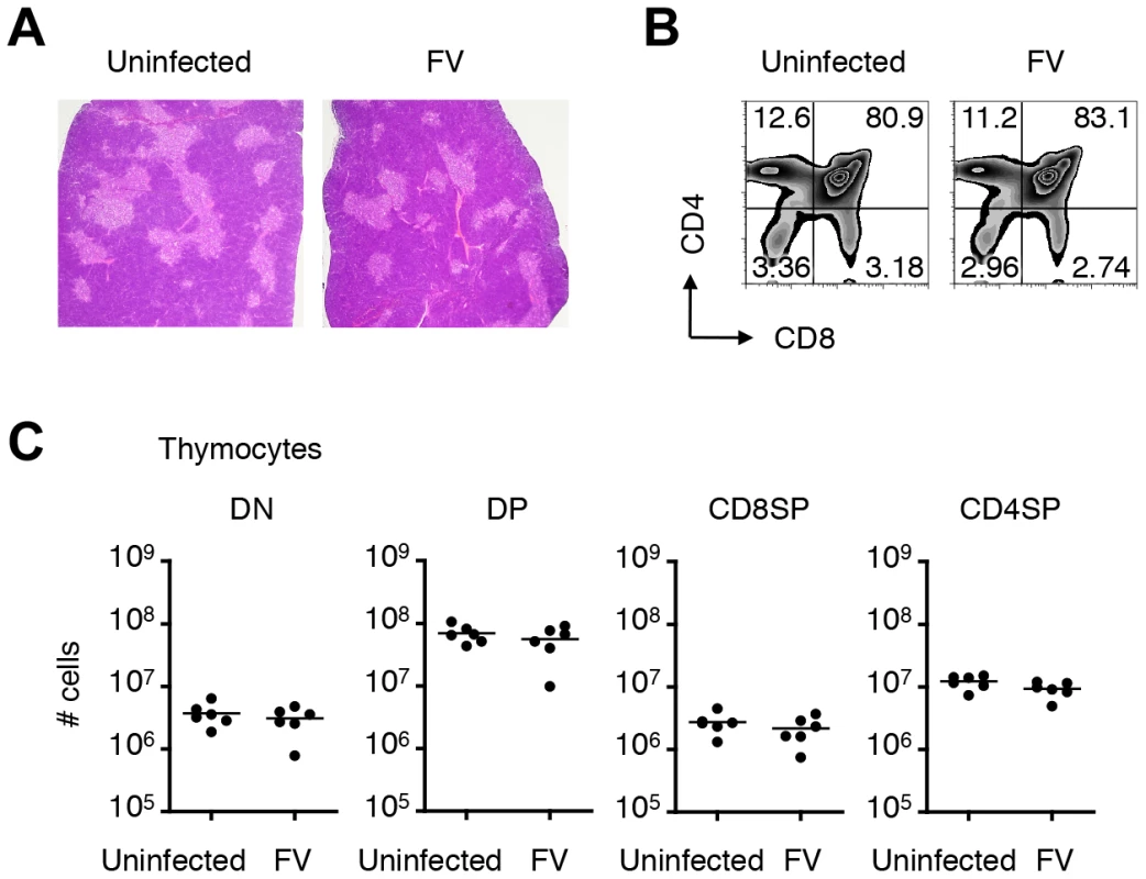Infection of thymus with FV has no influence on numbers and frequencies of thymocyte populations.
