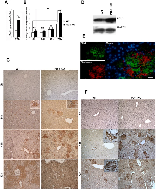 Higher FGL2 expression and stronger fibrinogen deposition in the liver of PD-1-deficient mice after MHV-3 infection.