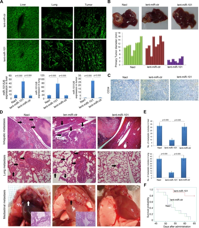 Systemic delivery of lent-miR-101 suppresses tumor growth, angiogenesis and metastasis in the orthotopic liver implanted HCC model of mouse.