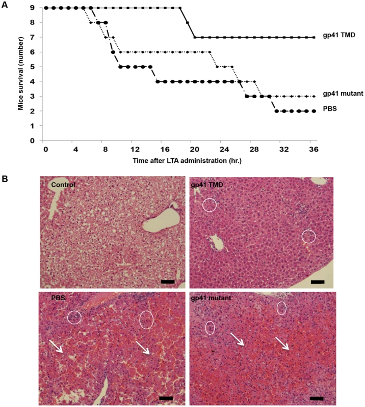 The gp41 TMD rescues mice in a LTA/GLN sepsis model and reduces liver damage.