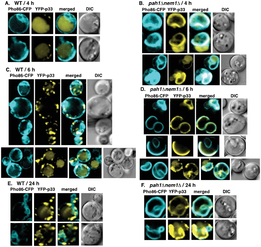 Rapid exploitation of expanded ER membranes by the tombusvirus p33 replication protein in <i>pah1Δ nem1Δ</i> yeast.