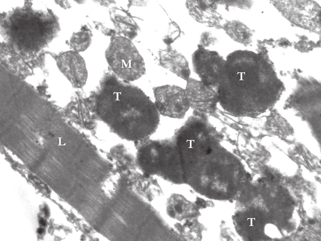Transverzálně probíhající myofibrily (T), různě denzí oblasti sarkomery s myosinovými filamenty a světlejší oblasti aktinových filament v longitudinálně probíhajících myofibrilách (L). V okolí myofibril nacházíme mitochondrie (M) s kristami (elektronogram, zvětšení 10 000x).