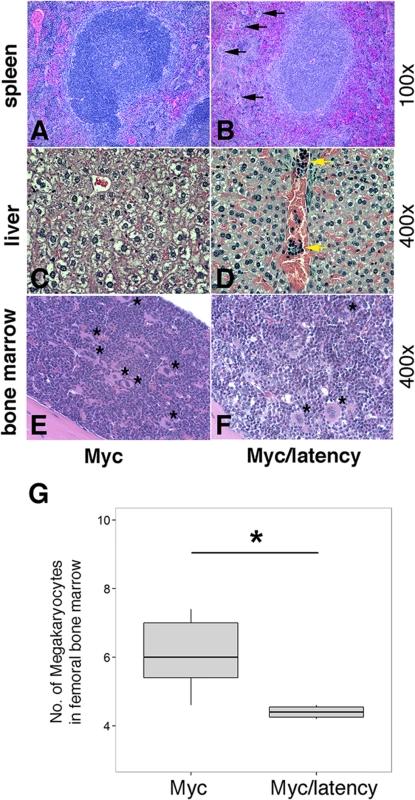 Severe EMH in the Myc/latency mice.