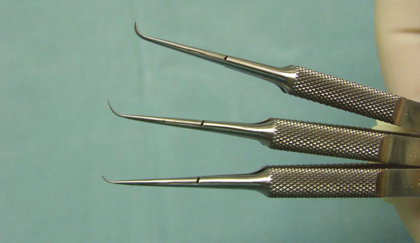 Nůžky používané k odstranění hluboké rohovkové lamely příjemce u operace typu DLEK