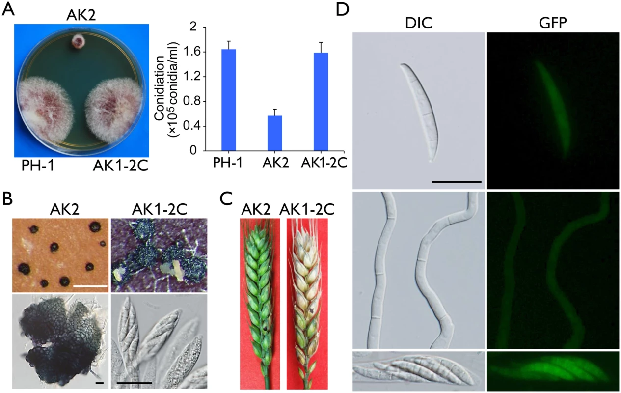 Defects of the <i>Fgcak1</i> mutant in vegetative growth, sexual reproduction, and plant infection and subcellular localization of FgCak1-GFP fusion protein.