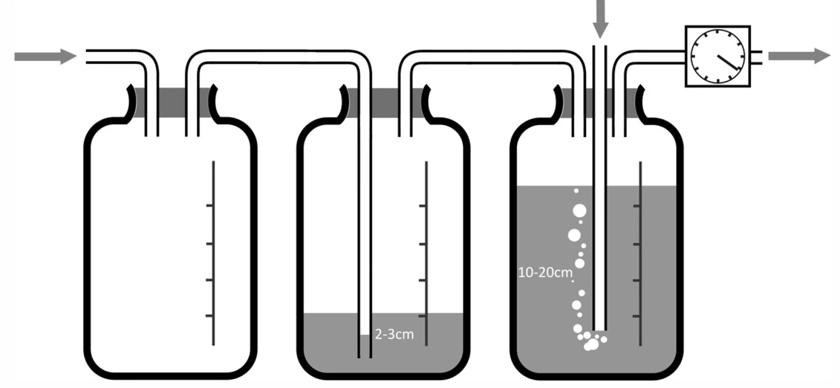 Vícelahvový systém pro hrudní sání a) dvoulahvový systém; b) třílahvový systém.
Fig. 5: Multi-bottle system for chest suction a) two-bottle system ;b) three-bottle system.