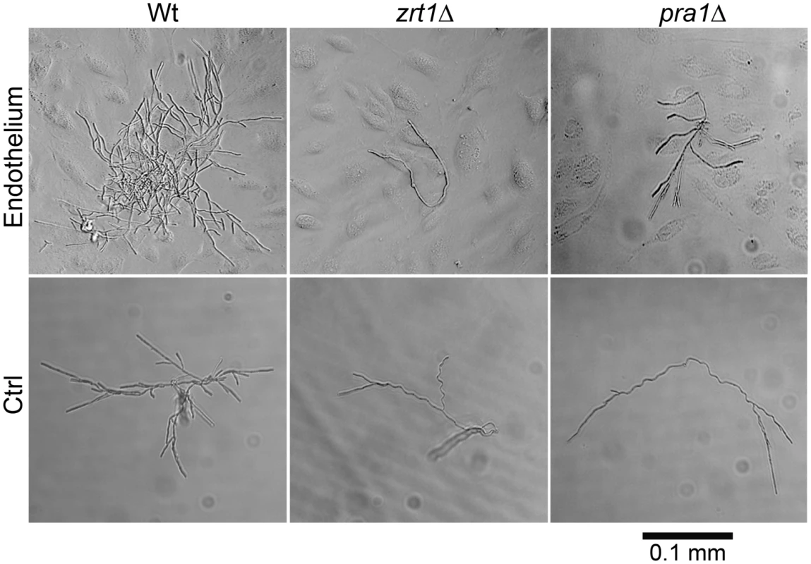 <i>ZRT1</i> and <i>PRA1</i> are required for microcolony development on endothelia in the absence of exogenous zinc.