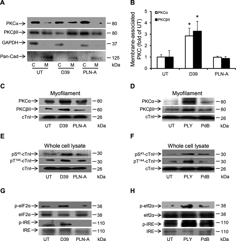 Activation of PKCα-cTnI pathway and ER stress in murine cardiomyocytes exposed to D39 or PLY.