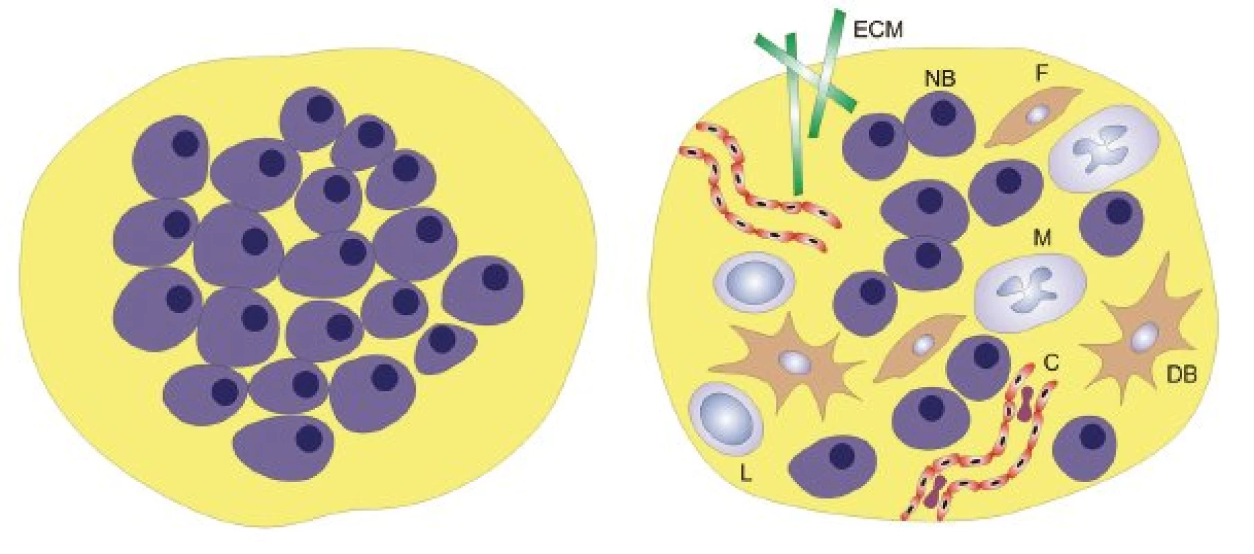 Redukcionistický a komplexní pohled na nádor. ECM – extracelulární matrix, F – fibroblast, M – makrofág, NB – nádorová buňka, DB – dendritická buňka, L – lymfocyt, C – céva.
