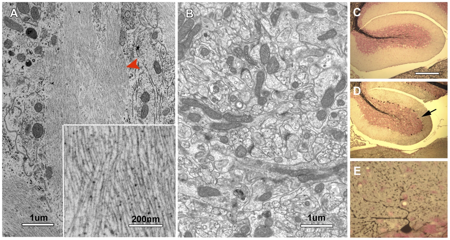 Neurofibrilary tangles in the cerebellum of <i>nur17</i> mice.