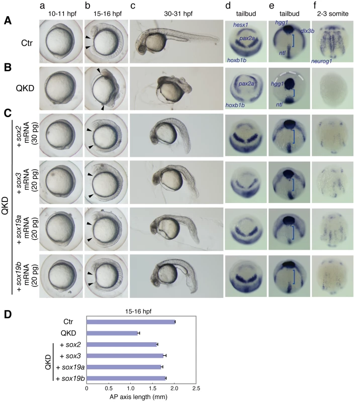 Rescue of the QKD phenotype by exogenous B1 <i>sox</i> mRNAs.