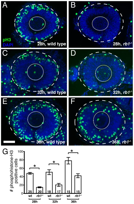 <i>rb1<sup>te226a</sup></i> retinas show delayed cell cycle exit during early retinogenesis.