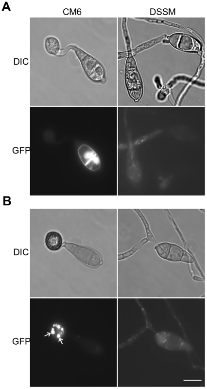 Expression and subcellular localization of MoMsb2-eGFP.