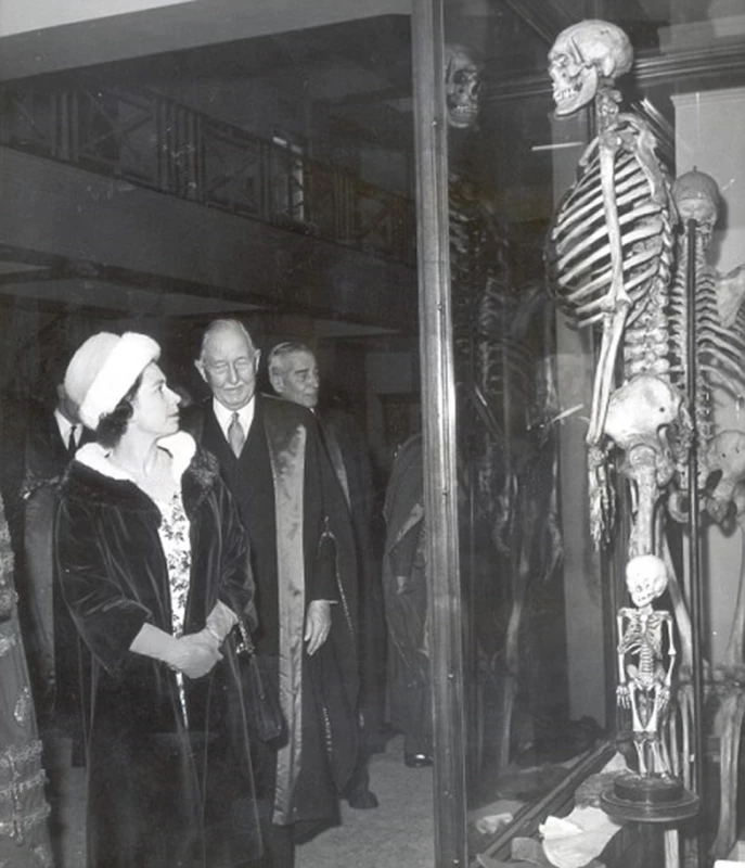 Královna Alžběta II. v roce 1962 před kostrou „irského obra“ Charlese Byrnea v Hunterově muzeu v londýnském sídle Royal College of Surgeons. Svůj dojem komentovala s královskou pokorou slovy „One feels very small...“.